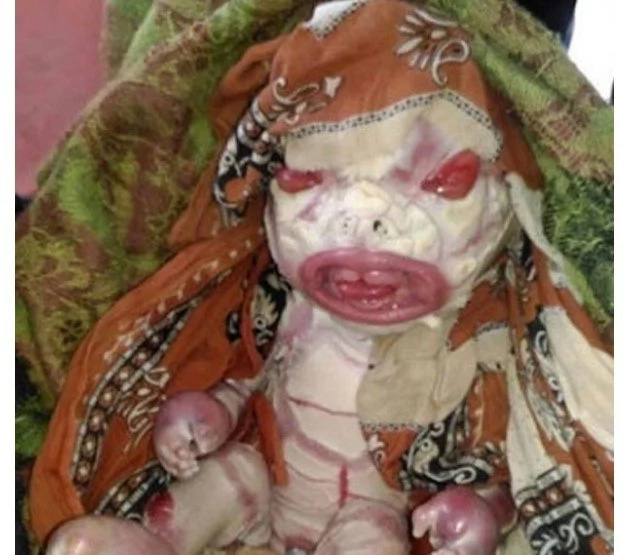 Mother afraid of own baby who looks like ALIEN, refuses to feed it