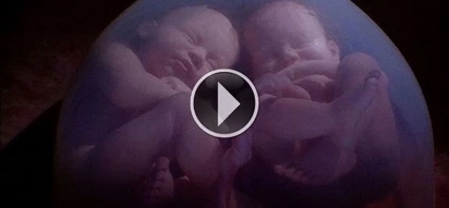 Awww! Adorable twin babies caught fighting in their mother's womb
