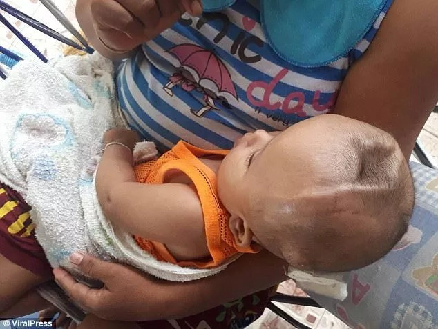 Tragedy as parents abandon 8-month old toddler living with a two-inch deep crack in the top of his head Tragedy as parents abandon 8-month old toddler living with a two-inch deep crack in the top of his head