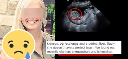 The reason why this mother decided to carry her dead child will make you cry