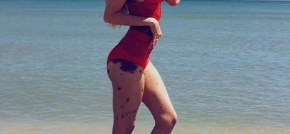 Read how this beautiful girl with a rare disease learned to overcome her fears!