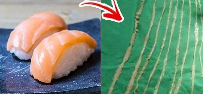 This girl ate sashimi. She regretted doing so after she finds 8-feet-long tapeworm in her tummy.