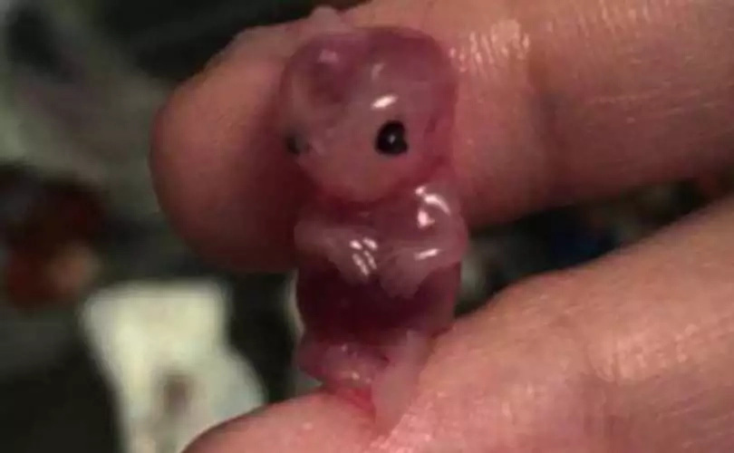 Woman Takes Abortion Pill, Sees Her 7-Week-Old Baby Woman Takes Abortion Pill, Sees Her 7-Week-Old Baby