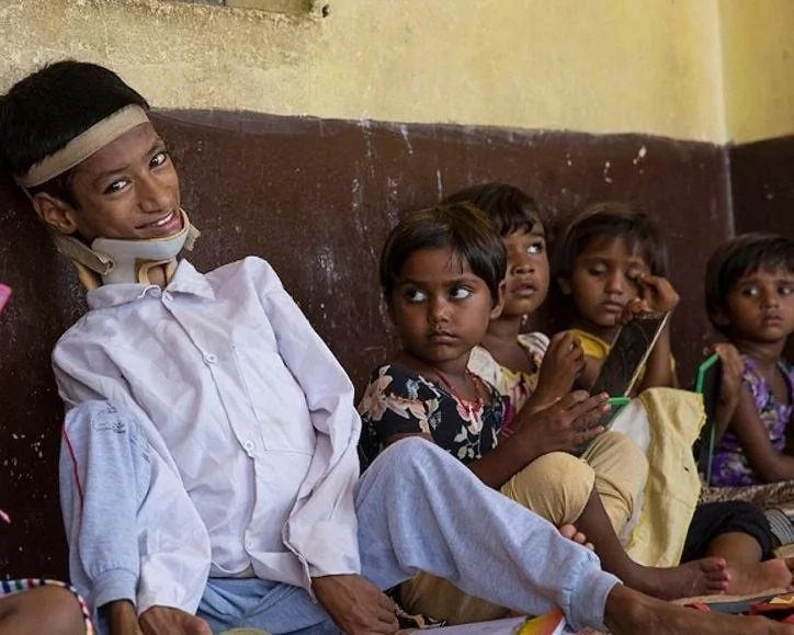 Mahendra's neck was not strong enough to keep his head upright Mahendra's neck was not strong enough to keep his head upright