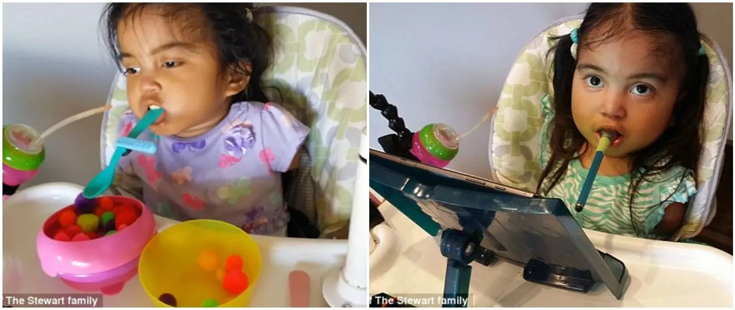 Inspiring! Parents adopt baby with no limbs, share their TOUCHING story (photos, video) Inspiring! Parents adopt baby with no limbs, share their TOUCHING story (photos, video)