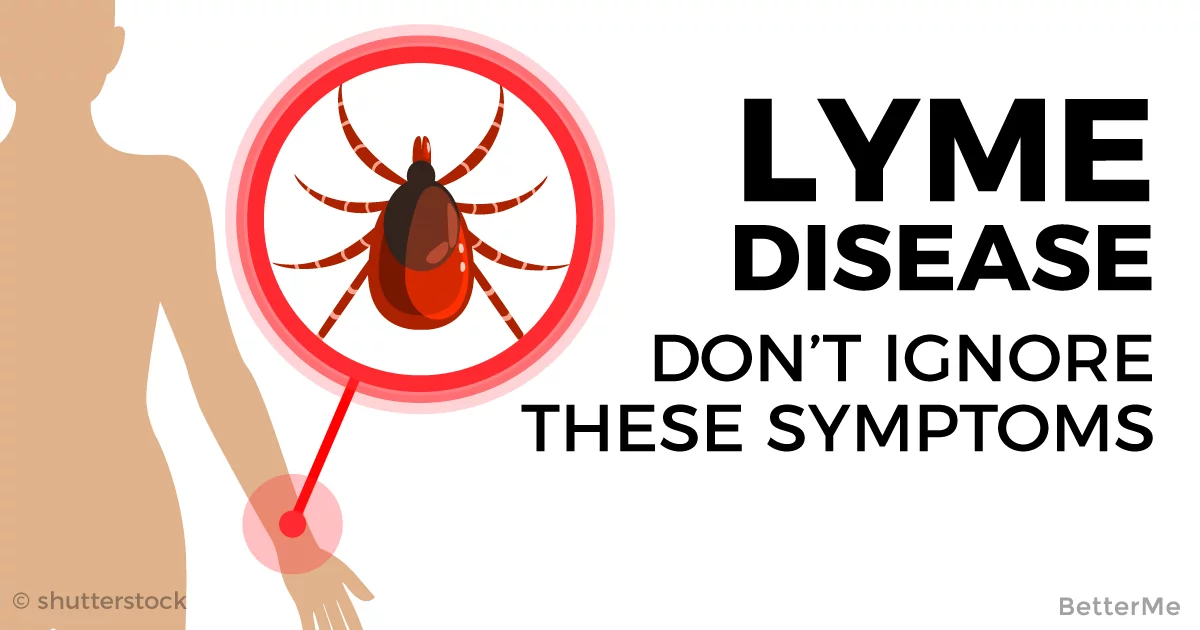 Don�t Ignore These Lyme Disease Symptoms