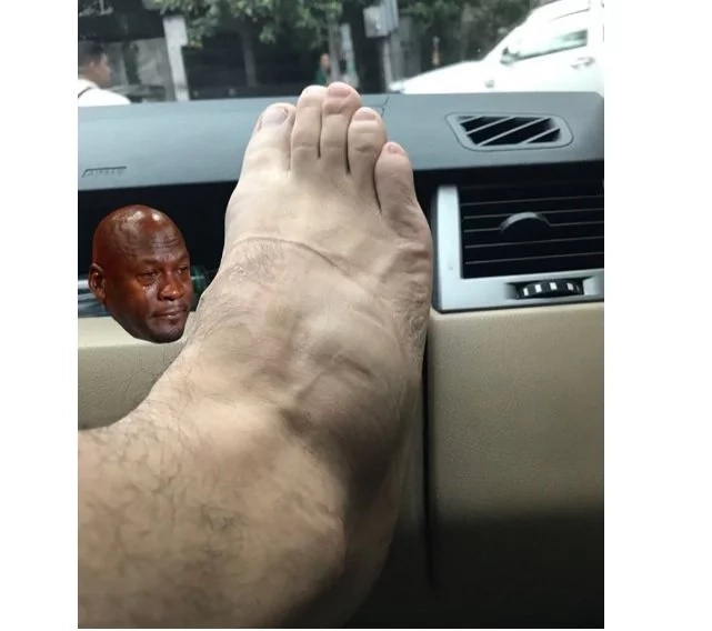 “So Yes, i have a fractured foot with quite a long healing time..” Luis Manzano On Instagram “So Yes, i have a fractured foot with quite a long healing time..” Luis Manzano On Instagram
