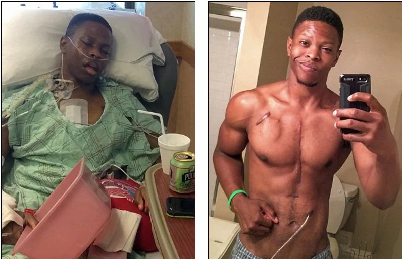 The story of this brave bodybuilder who has to wear his heart in a backpack is unbelievably shocking and touching The story of this brave bodybuilder who has to wear his heart in a backpack is unbelievably shocking and touching