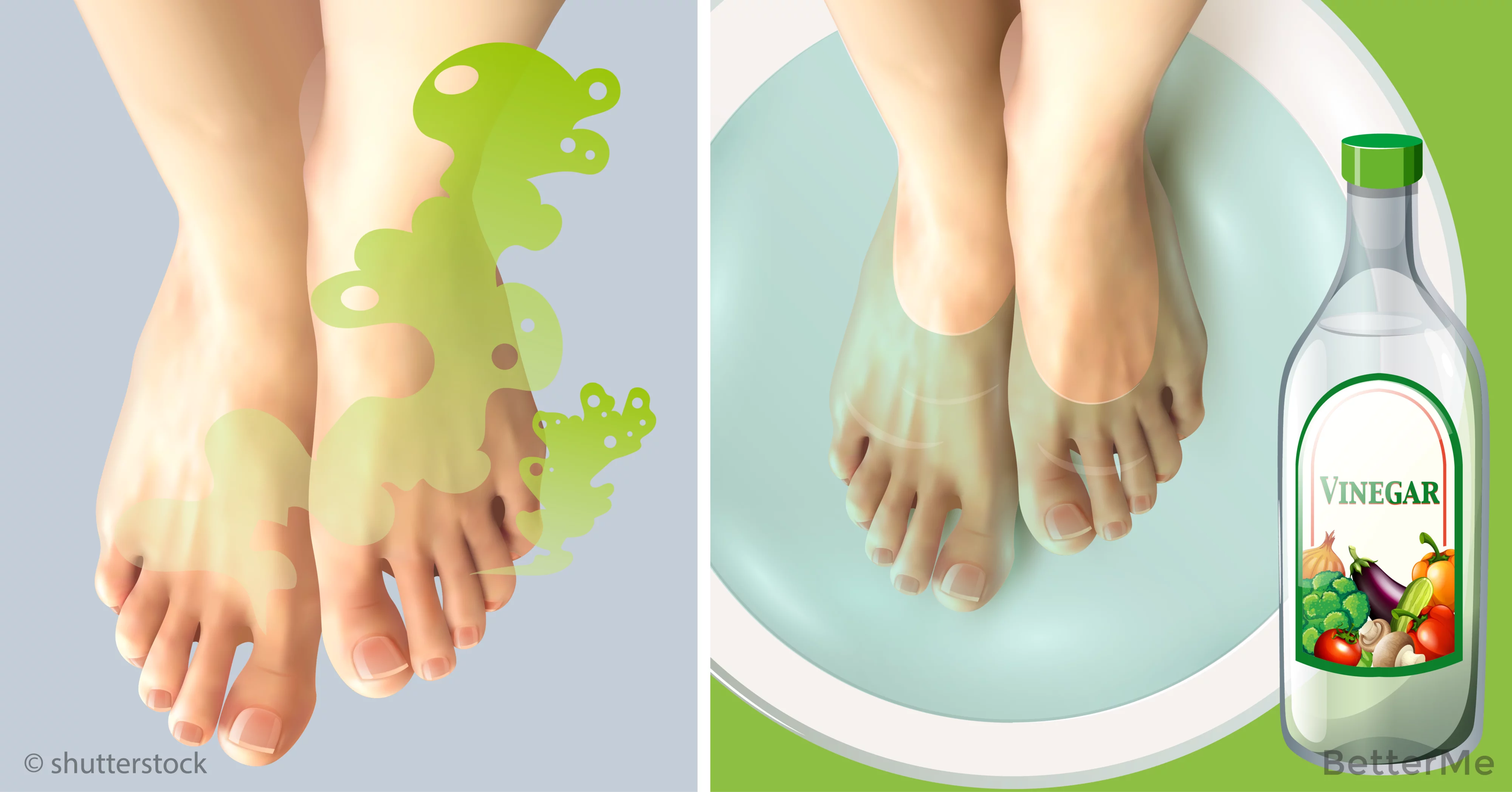 3 easy way to get rid of stinky feet fast