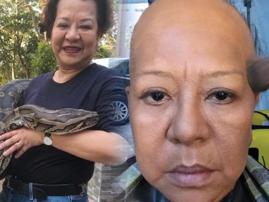 Mga artistang lumaban sa buhay! List of celebrities who have beaten cancer Mga artistang lumaban sa buhay! List of celebrities who have beaten cancer