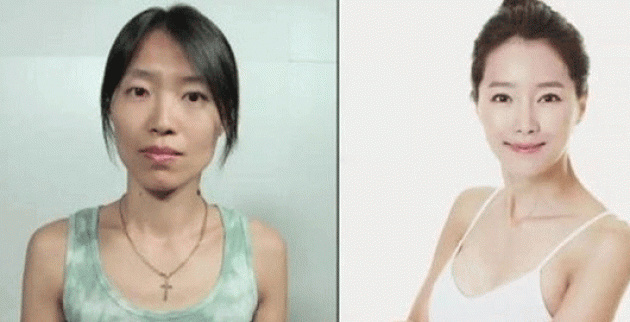 These women tried plastic surgery. The result? Shocking! These women tried plastic surgery. The result? Shocking!