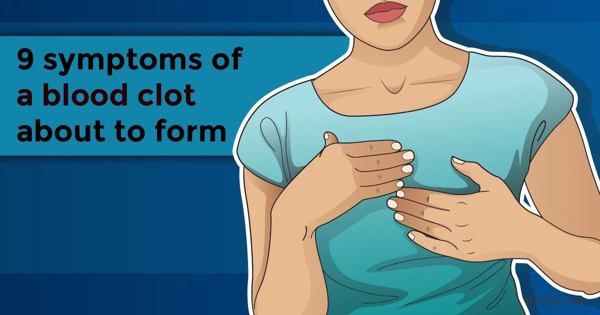 9 Clear Symptoms Of A Blood Clot About To Form