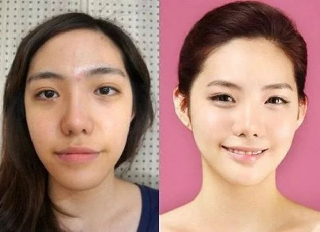 These women tried plastic surgery. The result? Shocking! These women tried plastic surgery. The result? Shocking!