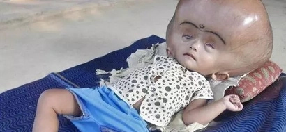 LOOK! Her parents thought she would die, what happened three years after will shock you!