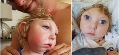A baby born with half of his skull happily celebrates his second birthday despite he was supposed to die already