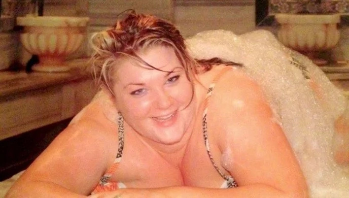 Woman was determined to completely transform her appearance before her wedding. So she spent $15,000 on plastic surgery & here’s how she looks now! Woman was determined to completely transform her appearance before her wedding. So she spent $15,000 on plastic surgery & here’s how she looks now!