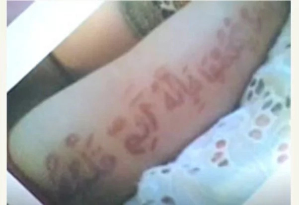 Allah's mircale! Quranic verses appear on BABY's skin (see photos, video)
