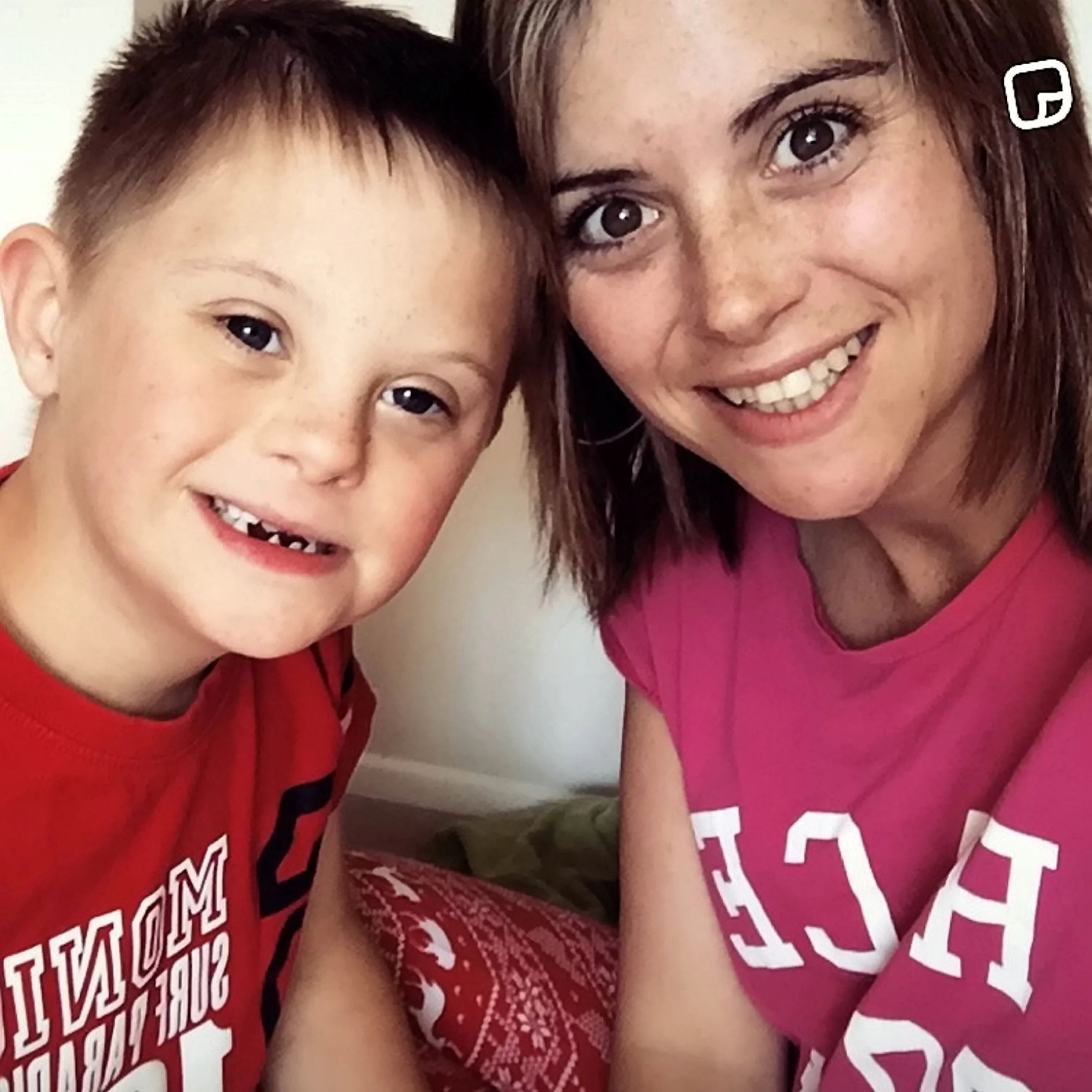 Mom calls her Down’s Syndrome child a “retard” because of this Mom calls her Down’s Syndrome child a “retard” because of this