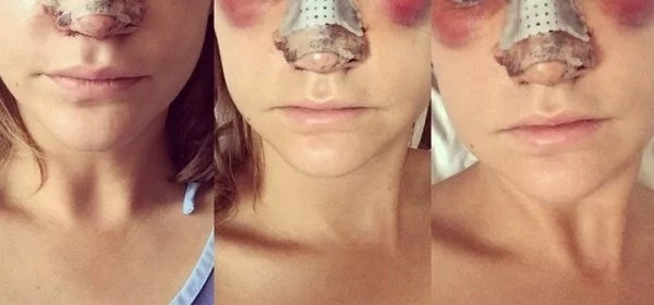 plastic-surgery plastic-surgery