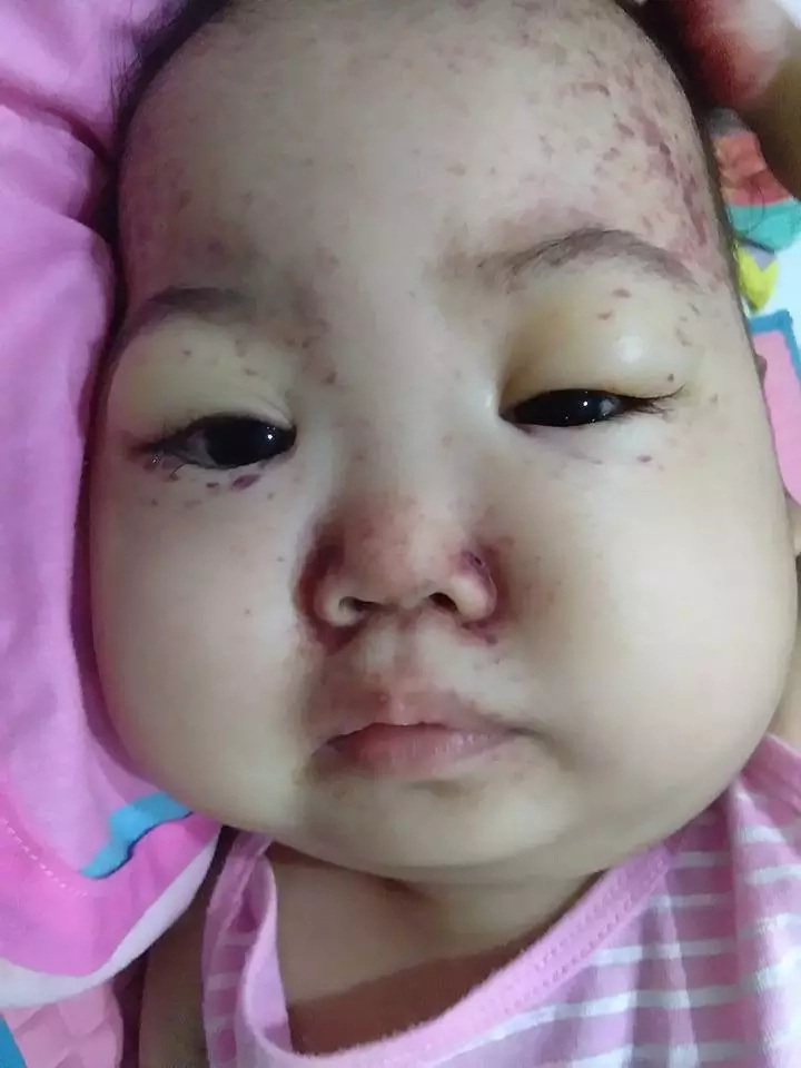 Child dies because doctor refused treatment Child dies because doctor refused treatment