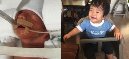 How this premature baby struggled to survive will make you believe in miracles