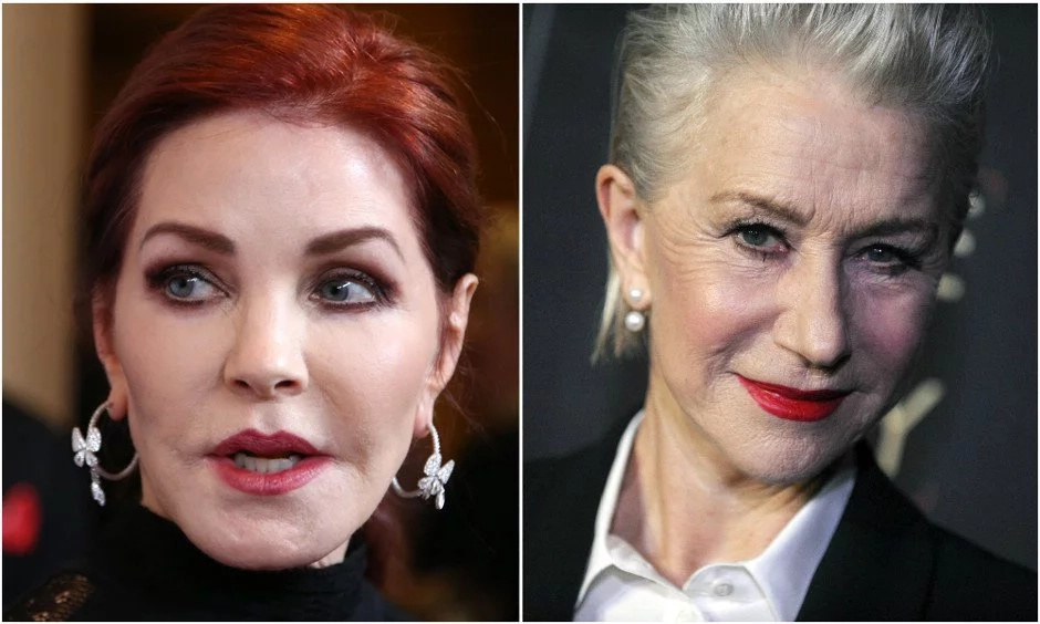 Plastic Surgery vs Natural Aging: How same-aged stars age differently