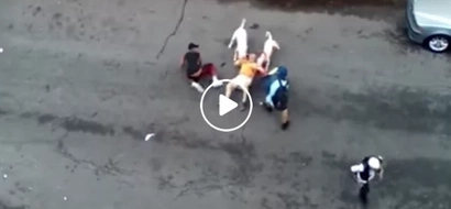 Nakakatakot! 62-year-old man near dead after brutally attacked by vicious pitbulls