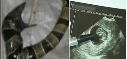 WATCH: This woman just gave birth to a snake