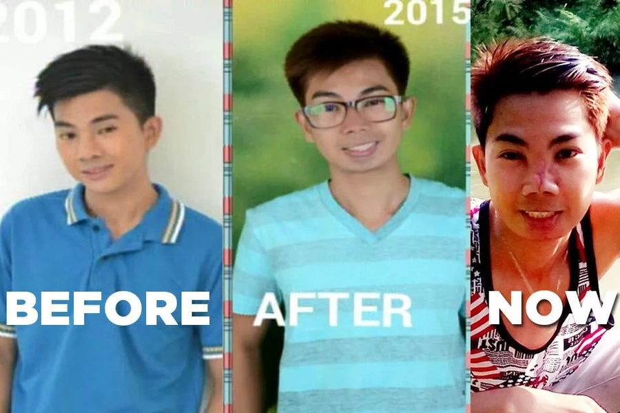 P500 nose job gone wrong P500 nose job gone wrong