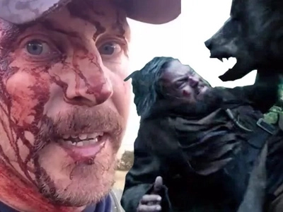 Hiker Escapes A Grizzly Bear Attack And Tells The Horrifying Story