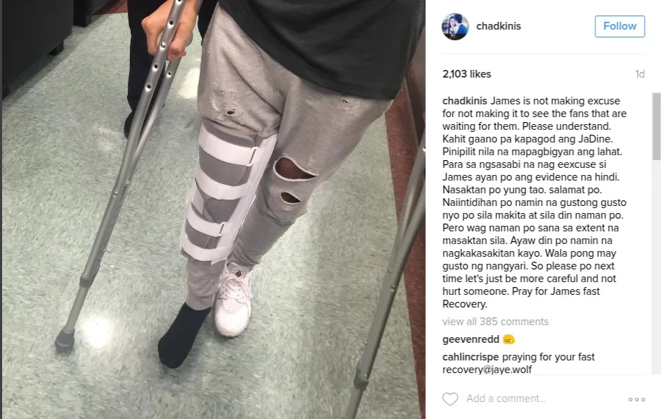 James Reid injured by fan James Reid injured by fan