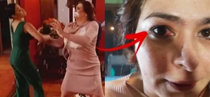Natotohanan pala! Maja Salvador accidentally hurts Aiko Melendez in the eye in 'Wildflower'
