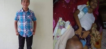 This 21-year old was a regular college student until he suffered a minor accident that led to his present condition