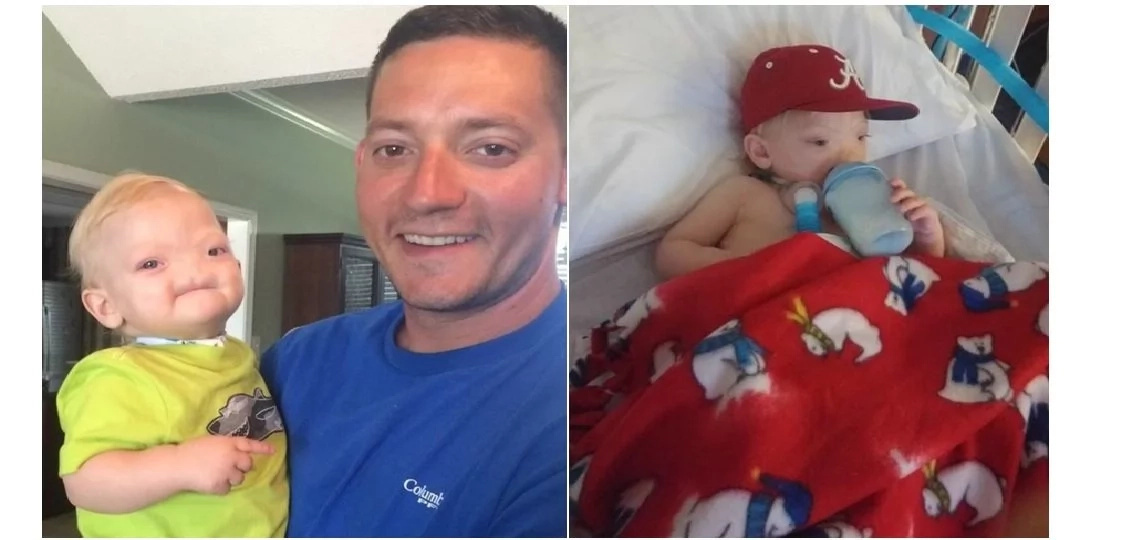 MIRACLE BABY! A baby was born without a nose and survived for 2 years! MIRACLE BABY! A baby was born without a nose and survived for 2 years!