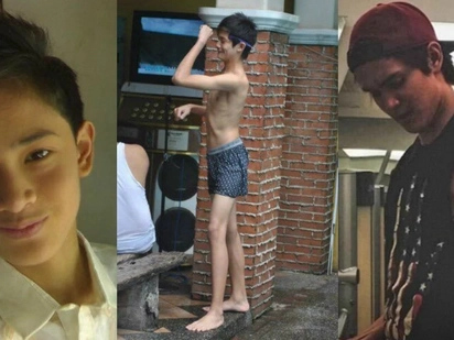 Iba din si Ybarro! Ruru Madrid shares his shocking puberty challenge transformation photos