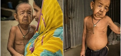 4-year-old boy stuck in the old man’s body due to horrendous disease
