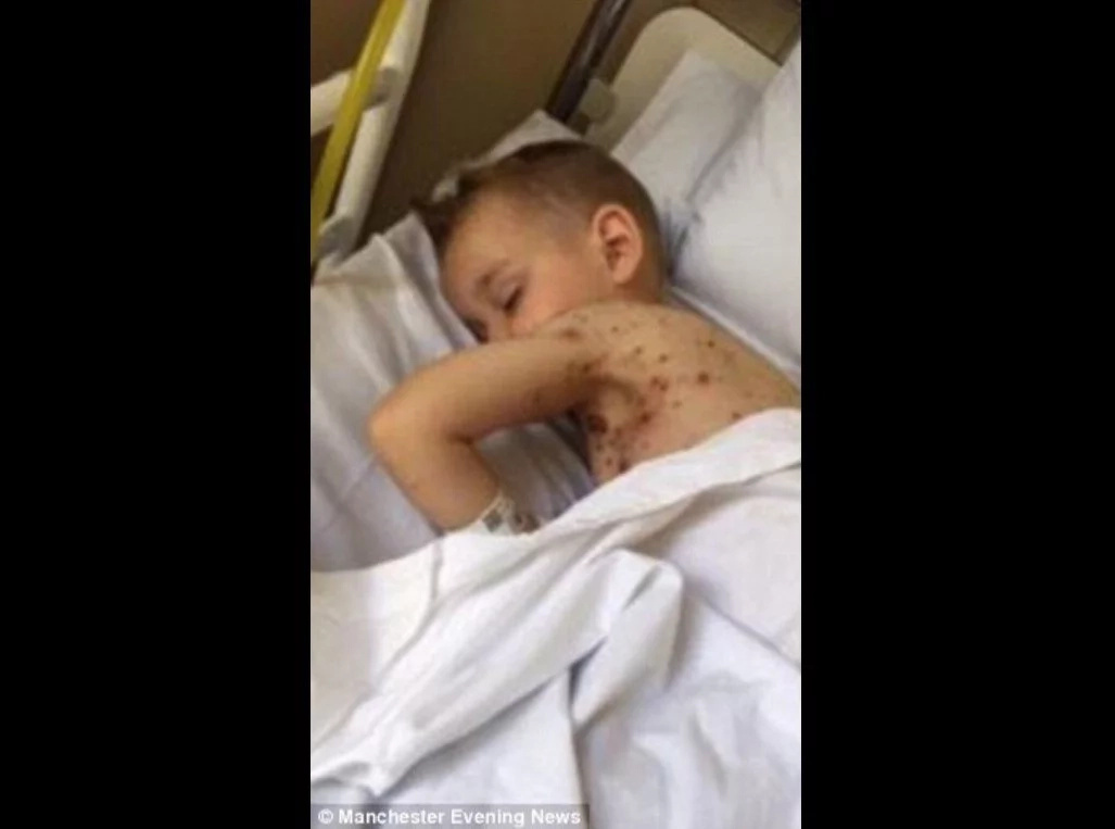 Horrifying Pictures Show Why You NEVER Give A Child Ibuprofen Horrifying Pictures Show Why You NEVER Give A Child Ibuprofen