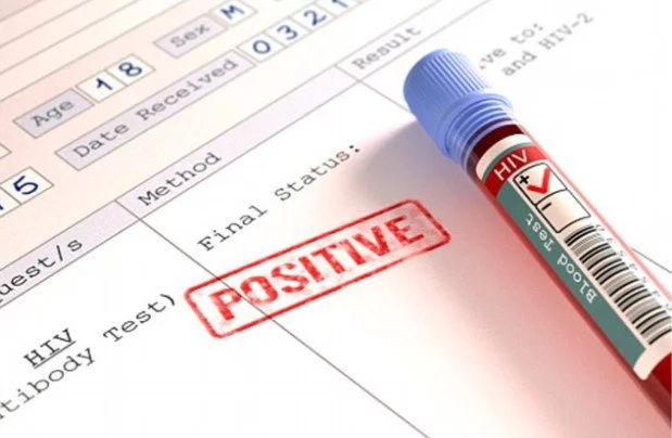 HIV is not death! See 6 steps to live NORMAL life, stay healthy and beautiful HIV is not death! See 6 steps to live NORMAL life, stay healthy and beautiful