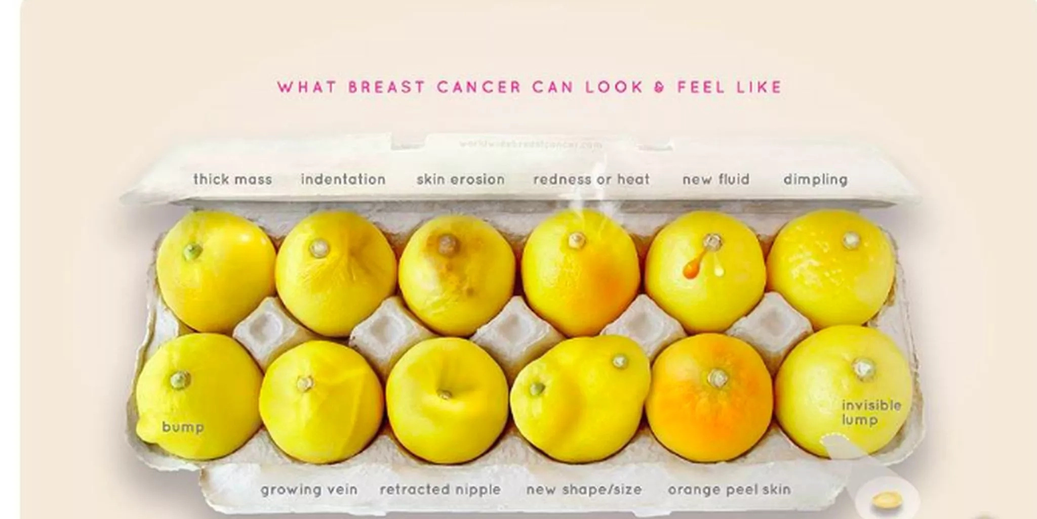 Breast of pictures early cancer signs Breast of pictures early cancer signs