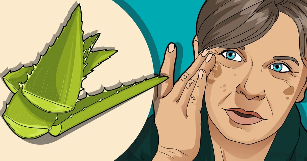 home remedies for beauty spots