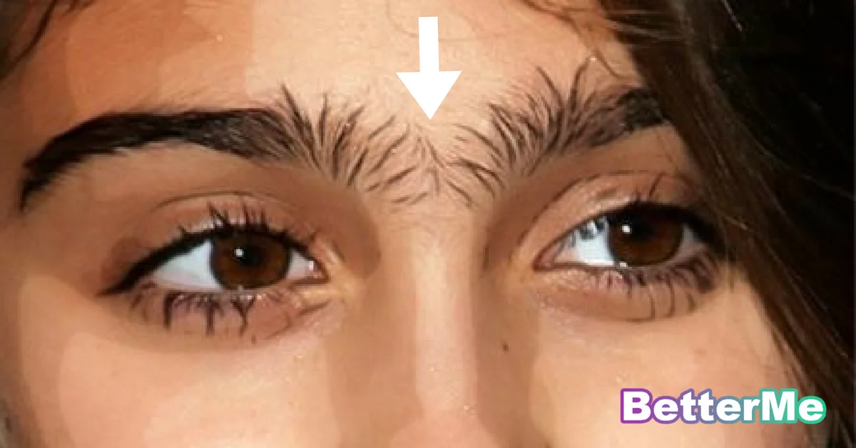 How To Get Rid Of A Unibrow Naturally Change Comin