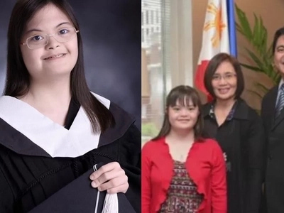 This is what happened to a girl with down syndrome who was told by the doctor that she might not live full life!