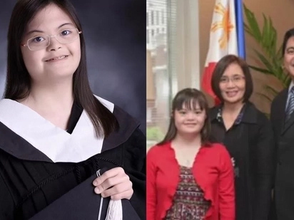 This is what happened to a girl with down syndrome who was told by the doctor that she might not live full life!