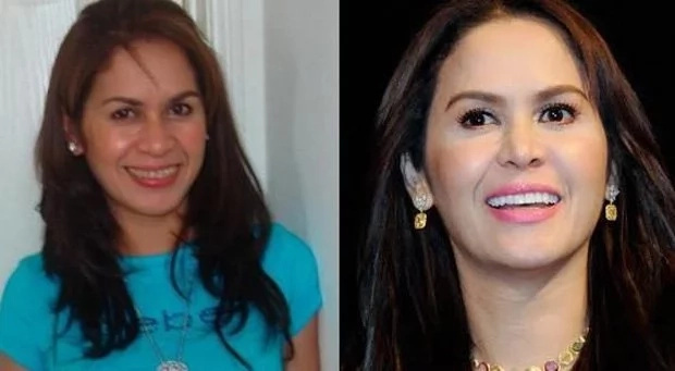 Jinkee Pacquiao has a noticeable transformation seen on her before and ...