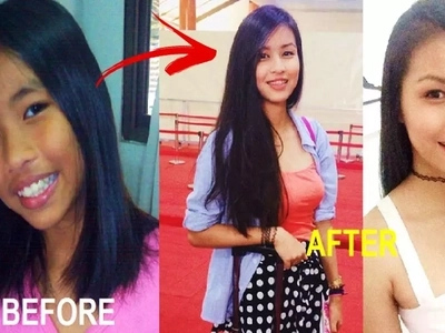 This Pinay stunned netizens with her photos before & after puberty! Check out her dramatic transformation!