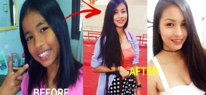 This Pinay stunned netizens with her photos before & after puberty! Check out her dramatic transformation!