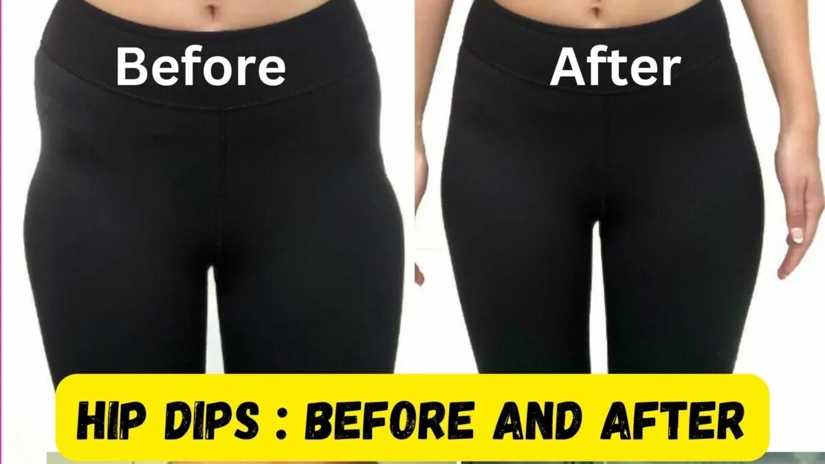 How to get rid of hip dips