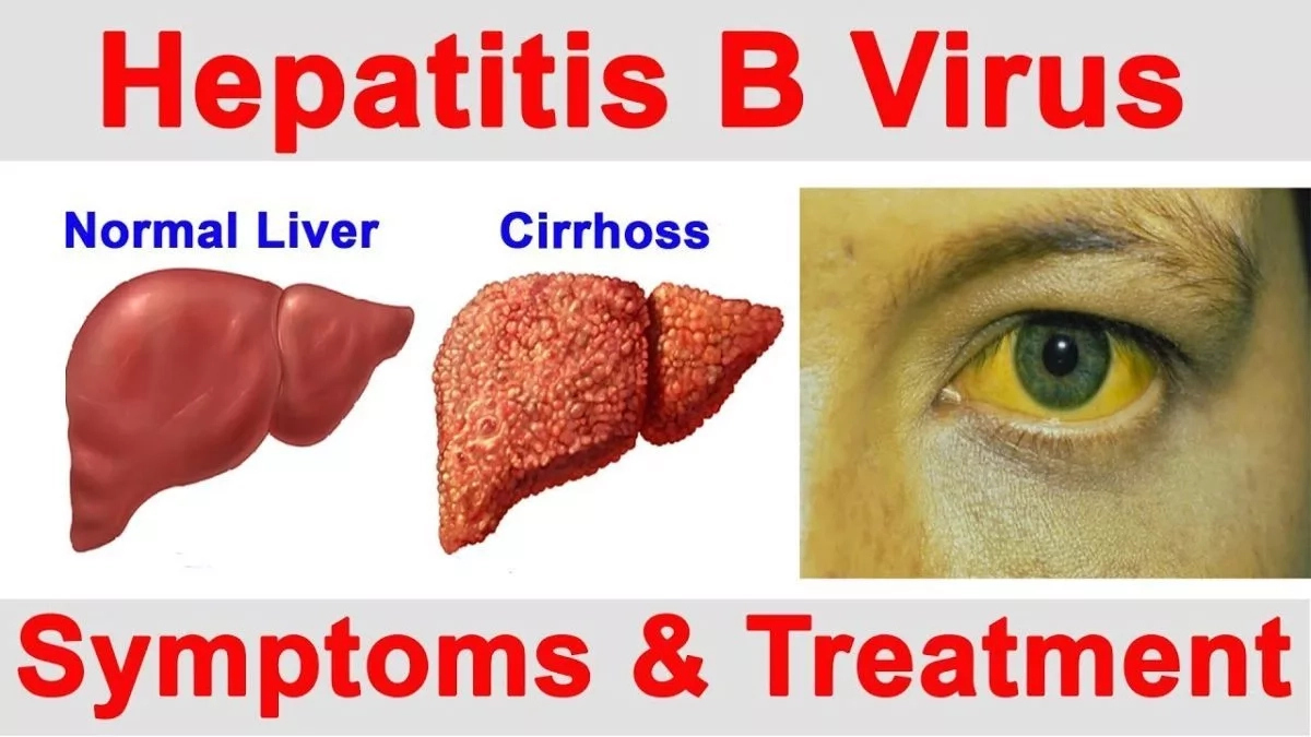 Causes and Cure for Hepatitis B