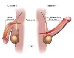 Erectile Dysfunction Solution in Nigeria