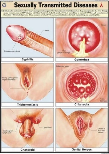 is klebsiella uti sexually transmitted